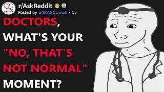 Doctors Whats Your No Thats Not Normal Moment? rAskReddit