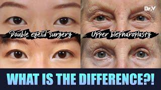 Facelift FAQ upper blepharoplasty VS double eyelid surgery