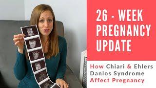 26-Week Pregnancy Update  How EHLERS DANLOS SYNDROME & CHIARI Affect Pregnancy
