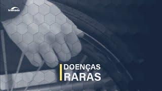 Doenças raras Senado discute neuromielite óptica que pode causar cegueira e até levar à morte