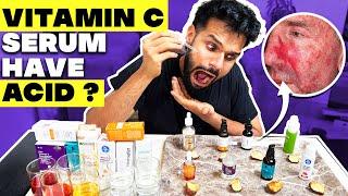 Testing The Best Vitamin C Serum For Indian Skin *Shocking Result*  BeYourBest Skincare San Kalra​