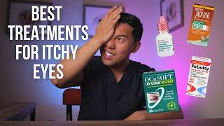 How to Treat Itchy Eyes Top 5 BEST Itchy Eye Treatments Explained by an MD