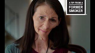 CDC Tips From Former Smokers - Christine B. Oral Cancer Effects
