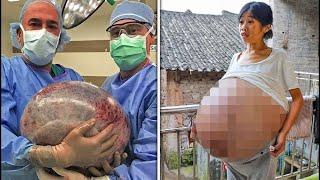 A woman with a giant belly that weighs 15 kilos and keeps on growing  STREAM