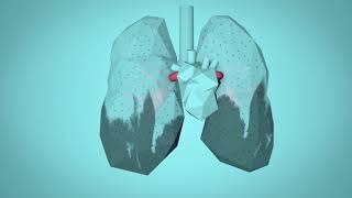 WHO Breathe Life - How air pollution impacts your body