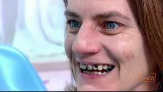 Rotten Teeth  Embarrassing Bodies