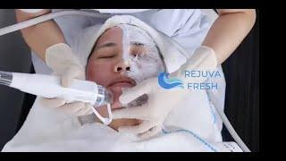 How to Use the Pro Secret Icy Gold RF Microneedling Machine  Microneeding Facial Treatment Demo