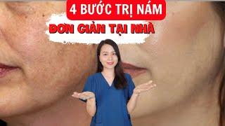 Nám da mặt và cách chữa trị 4 bước đơn giản ngay tại nhà  Nguyễn Mai Hương