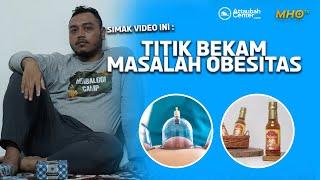 Mengenal Lebih Dekat Thibbunnabawi - Titik Bekam Masalah Obesitas