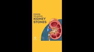 Foods that contribute in Kidney Stone formation #shorts