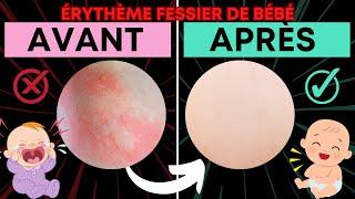 10 actions pour soigner les fesses rouges irritées de bébé