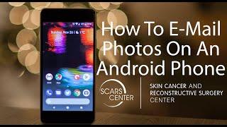 How To Email Photos With Your ANDROID PHONE  Telehealth Appointments with SCARS Center