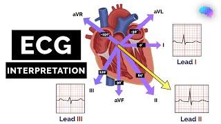 How to Read an ECG  ECG Interpretation  EKG  OSCE Guide  UKMLA  CPSA