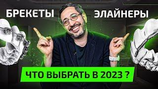 Брекеты или Элайнеры — что лучше в 2025 году? Плюсы и Минусы