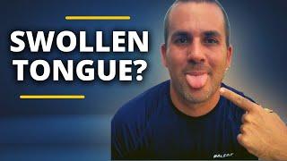 SWOLLEN TONGUE Enlarged Tongue  Symptoms and How To Heal Peripheral Neuropathy