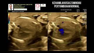 Kehamilan 23 minggu perkembangan normal