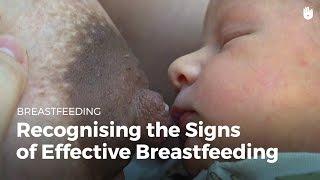 Recognizing the signs of effective breastfeeding  Breastfeeding