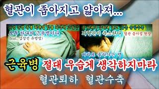 근육병 절대 우습게 생각하지 마라. 혈관이 좁아지고 얇아져 최종적으로 혈관을 막히게 해서 생명을 위협한다. 스트레스 호르몬보다 질병을 더욱 일으킨다.