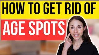 How To Get Rid Of Age Spots  Dermatologist Tips