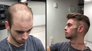 Hair Replacement fitting video David part 2 – Hair Inspira