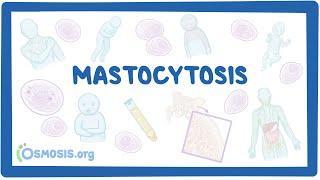 Mastocytosis NORD