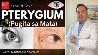 Pterygium Pugita sa Mata Causes Symptoms Complications Treatment & Prevention