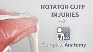 Rotator Cuff Injuries  Complete Anatomy