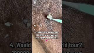 WHAT A GREAT POP #extractionsatisfaciton #ingrownhair #ingrownhairremoval