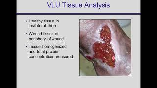 A Multi-Faceted Expert’s Approach to Managing Venous Disease and Venous Leg Ulcers