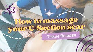 Scar Therapy  Techniques - Tissue Release  C-Section Scarring and Recovery with HLP Therapy