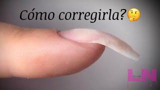 Cómo corregir uñas convexas