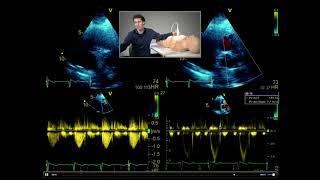 How to perform a full comprehensive transthoracic echo study