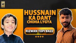 Hussnain ka dant choha ly gya  rizwan topi baz  vlog by rohan  funny vlog 2024