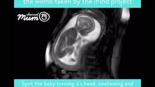 MRI Scan Video of Baby Moving in Womb  Channel Mum