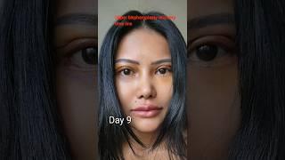 Blepharoplasty recovery