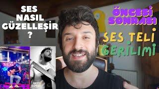 SES NASIL GÜZELLEŞİR ?  GERİLİM TRAVMASINI NASIL ÇÖZDÜK ?  ÖNCESİ SONRASI