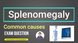 Splenomegaly. Exam Question.