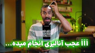 آنالیزور اسکالپ با هوش مصنوعی روتونیکس – Rootonix