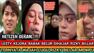 Wajah Lesty Kejora Babak Belur Akibat KDRT yang Dilakukan Rizky Bilar Wajah Lugu Rizky Billar Menipu