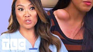 The Contents Of This Huge Bump Surprises Dr Lee  Dr. Pimple Popper