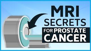 MRI Secrets for Prostate Cancer #prostatecancer