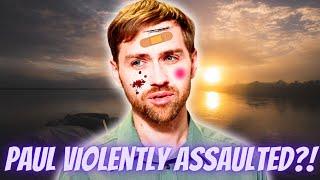 90 Day Fiancé Paul Staehle BRUTALLY Assaulted In Brazil And Rushed To Hospital?