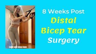 8 weeks post distal bicep tear repair