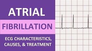 Atrial Fibrillation A-Fib ECG Treatment Causes Nursing NCLEX Review ACLS