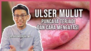 4 Cara Hilangkan Ulser Mulut. Bagaimana Ulser Terjadi  Bibir Lelangit Mulut dan Lidah.