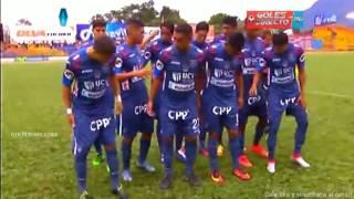 Union Comercio vs Cesar Vallejo Partido Completo   Clausura 2016 