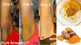 How to get rid of dark armpits in 3 days. SHOCKING RESULT I tried this home remedy