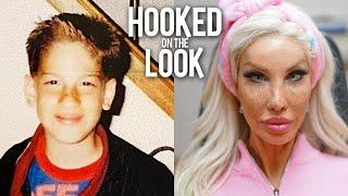 From Teen Boy To $1M Plastic Barbie  HOOKED ON THE LOOK