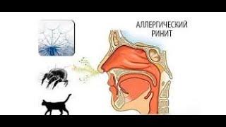 Аллергический ринит часть 1