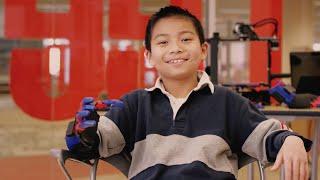 3D Printed Hand Gives 10-yr-old Boy New Powers